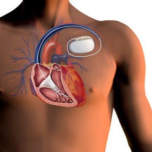 Figure-4-ICD-image